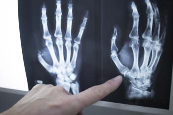 Radiology is an integral part of Arthritis & Rheumatology Center